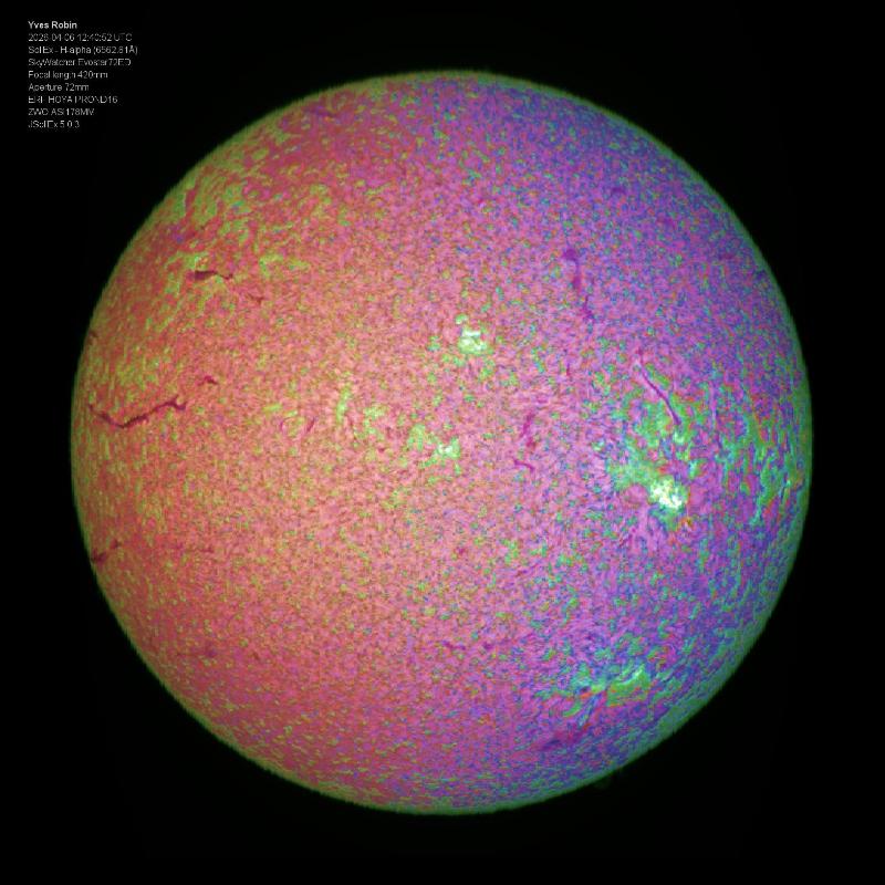 Tomographie